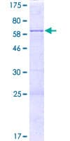 Human PPP1R21 / KLRAQ1 Protein (Recombinant GST)