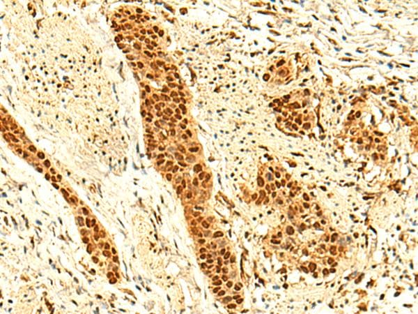 UNKL Antibody