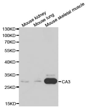 Polyclonal Rabbit anti-Human CA3 / Carbonic Anhydrase III Antibody (IHC, IF, WB)