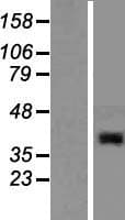 ABHD13 Protein (Over-Expression Lysate Myc-DDK (Flag))