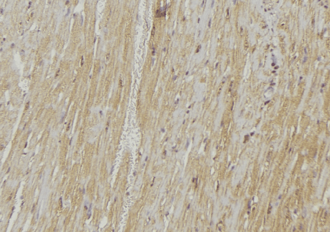 Polyclonal Rabbit anti-Human VAMP1 / VAMP-1 Antibody (IHC, WB)