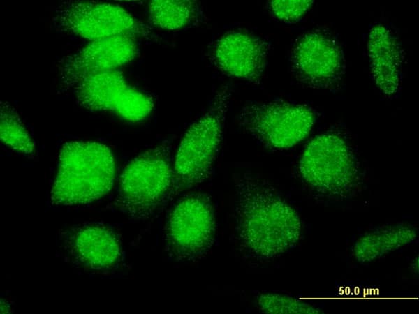 IHC-plus™ Monoclonal Mouse anti-Human E4F1 / E4F Antibody (clone 4B10, IHC, IF, WB)