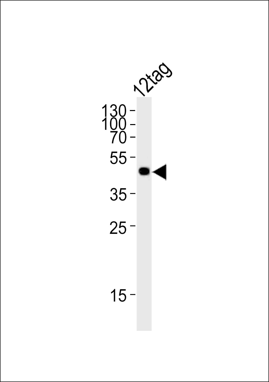 DYKDDDDK Tag Antibody