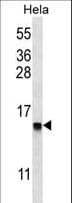 DEFB112 Antibody (aa15-43)