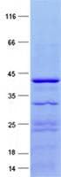 Human PALB2 Protein (Recombinant His, N-Terminal)