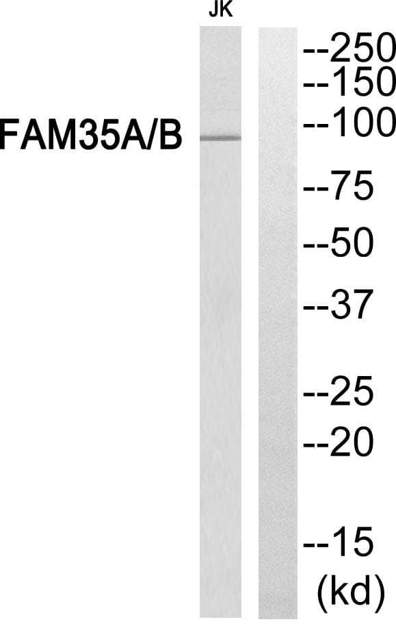 Polyclonal Rabbit anti-Human FAM35A + FAM35B Antibody (WB)