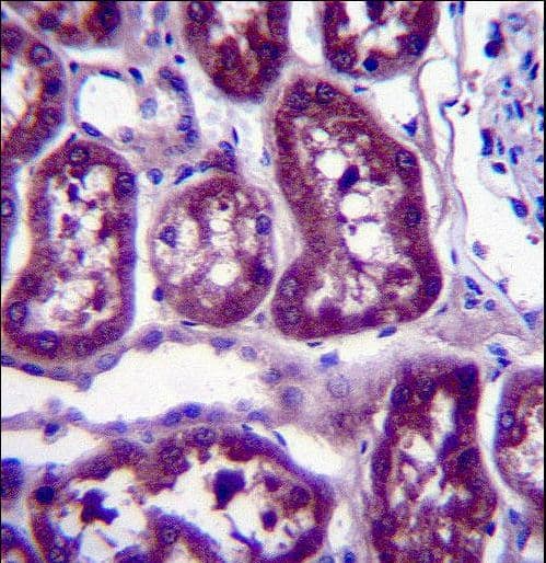 DPYS / Dihydropyrimidinase Antibody (aa454-482)