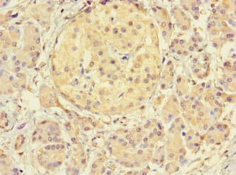 Polyclonal Rabbit anti-Human THADA Antibody (IHC, IF)