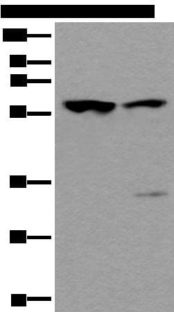 TRIM27 Antibody