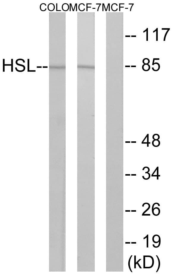 Polyclonal Rabbit anti-Human LIPE / HSL Antibody (aa518-567, IHC, WB)