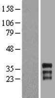 HOXC11 Protein (Over-Expression Lysate Myc-DDK (Flag))