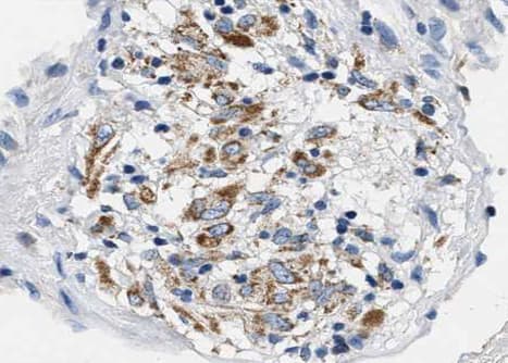 BCL2L1 / BCL-XL Antibody (phospho-Ser62)