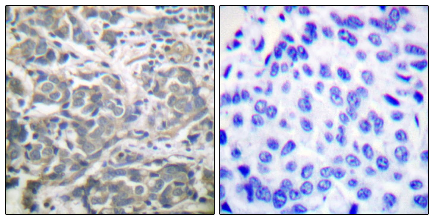 PRKAA1 + PRKAA2 Antibody (aa140-189)