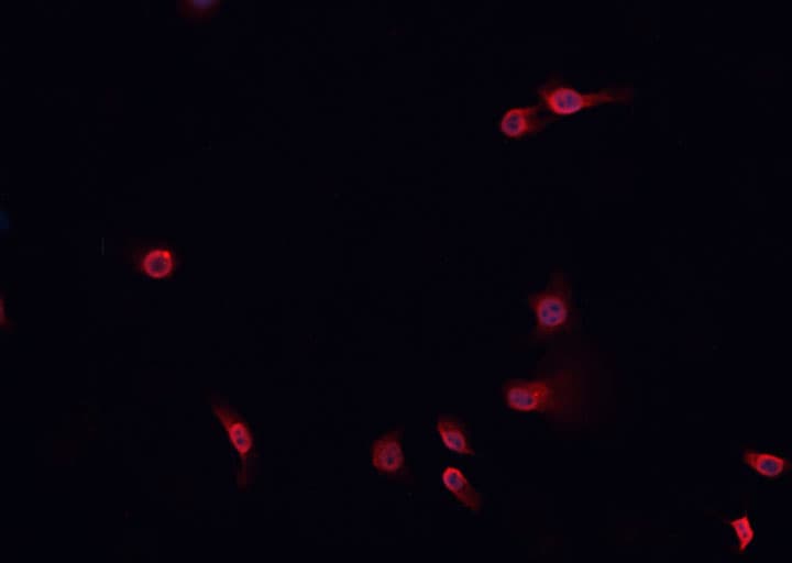 Polyclonal Rabbit anti-Human NOTCH2 Antibody (Cleaved Asp1733, IHC, IF, WB)