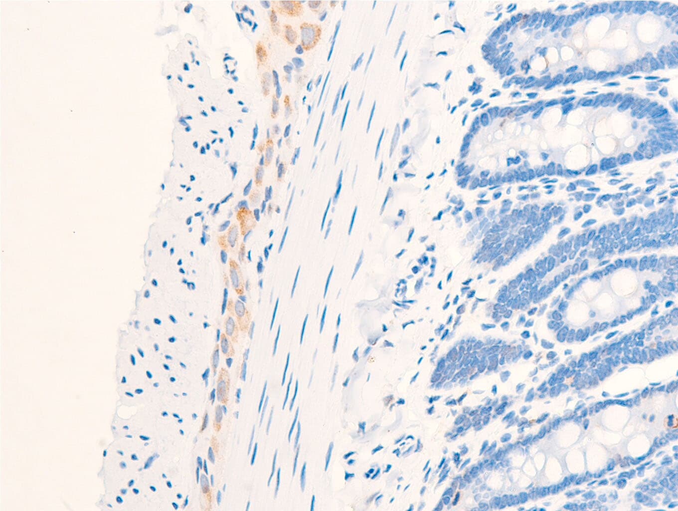 EGFR Antibody (phospho-Ser1026)