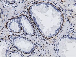 AK5 / Adenylate Kinase 5 Antibody (clone OTI2A2)