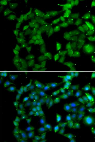 PRKAB2 / AMPK Beta 2 Antibody