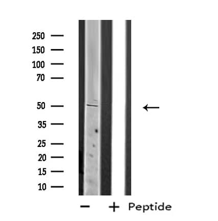 PLAGL1 / ZAC Antibody