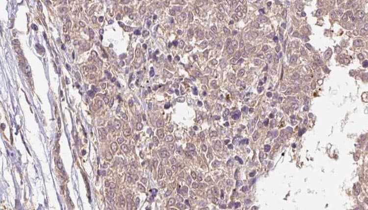 Polyclonal Rabbit anti-Human MLANA / Melan-A Antibody (IHC, IF, WB)