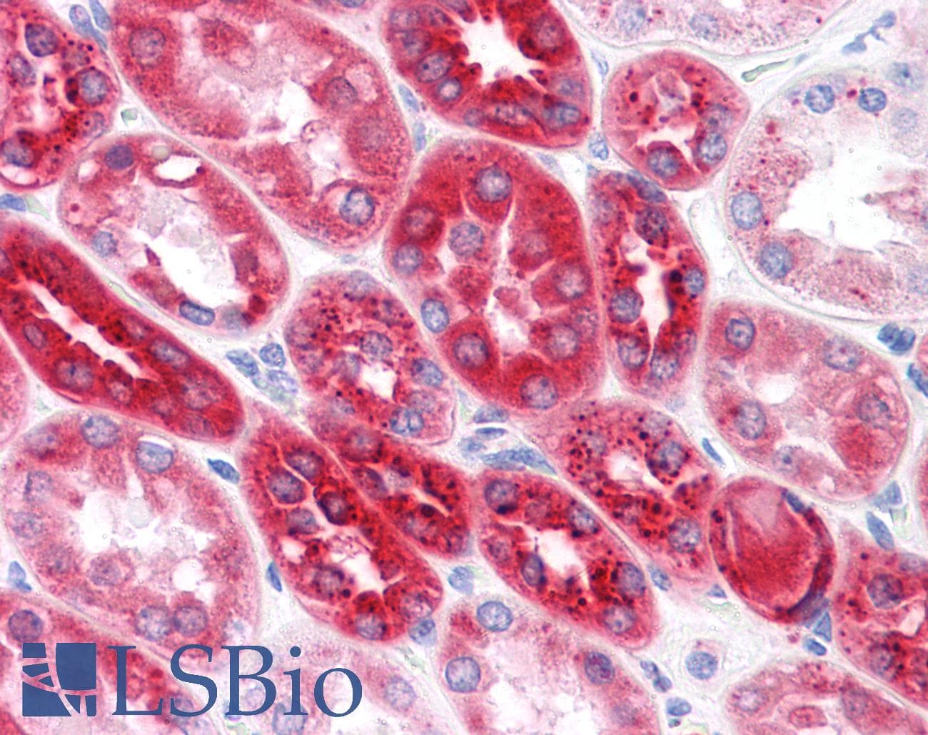 IHC-plus™ Monoclonal Mouse anti-Human CPVL Antibody (clone 2G5-1C1, IHC, IF, WB)