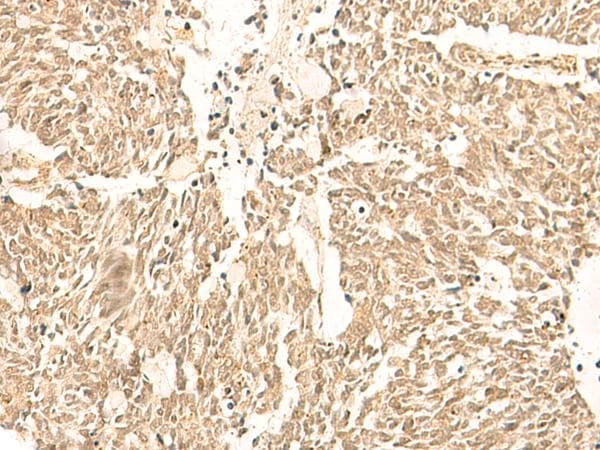 TBPL1 / TRF2 Antibody