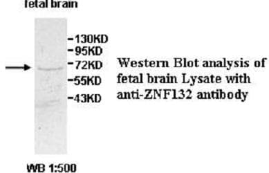 Polyclonal Rabbit anti-Human ZNF132 Antibody (aa212-477, WB)