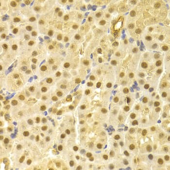 CDC25A Antibody