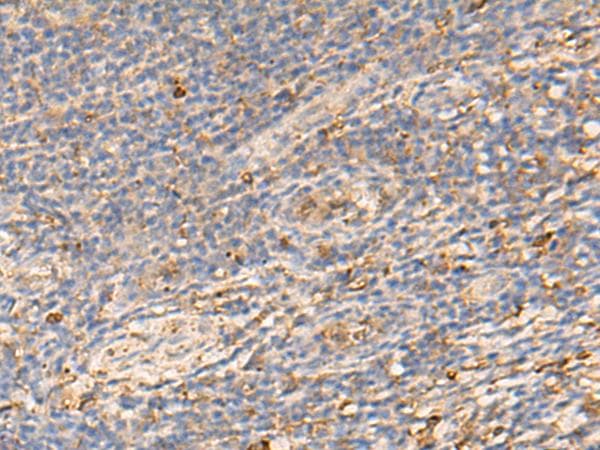 Polyclonal Rabbit anti-Human PDIA5 / PDIR Antibody (IHC, WB)