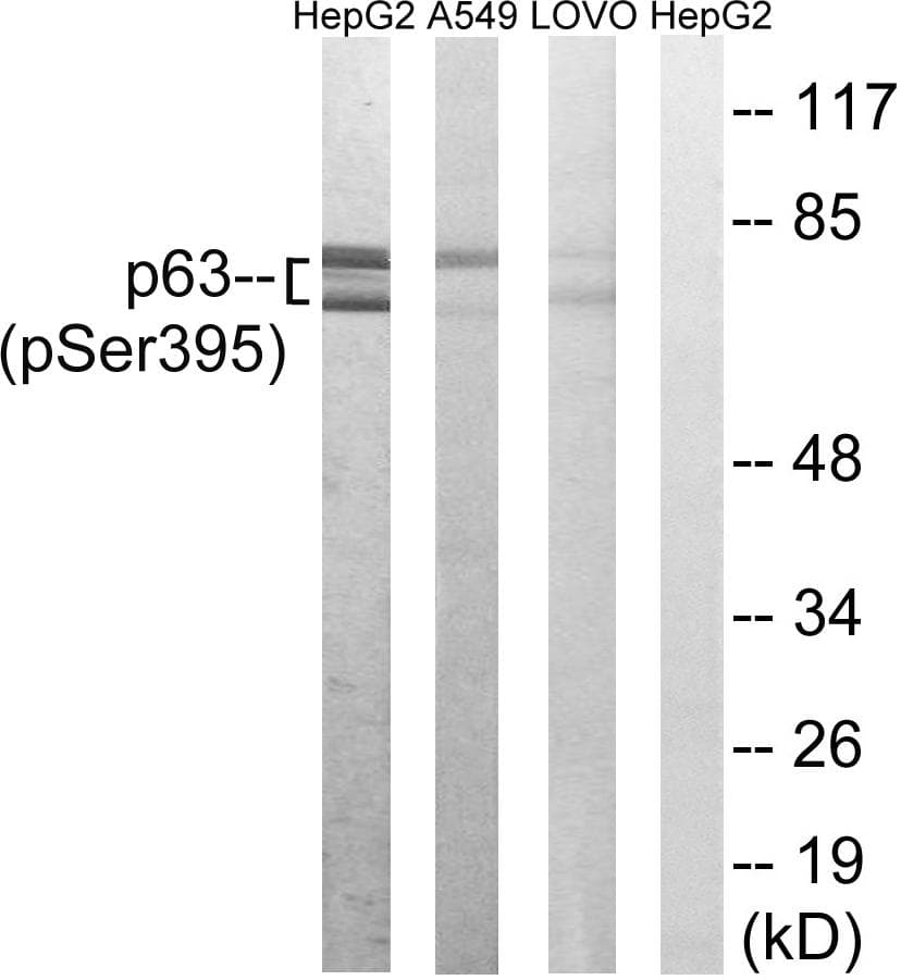 TP63 / p63 Antibody (phospho-Ser395)