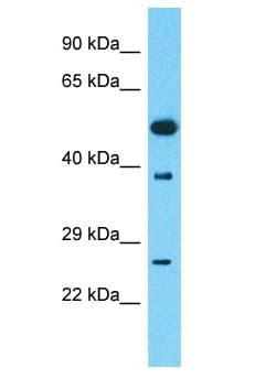 PSMD4 / RPN10 Antibody (aa284-333)