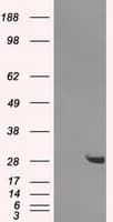 HDHD2 Antibody (clone OTI2C12)