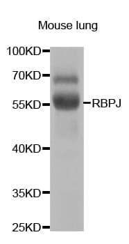 Polyclonal Rabbit anti-Human RBPJ Antibody (IHC, IF, WB)