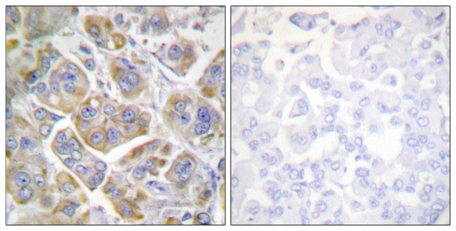 ITGB4 / Integrin Beta 4 Antibody (p1510)