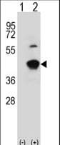 GCAT Antibody (aa155-181)