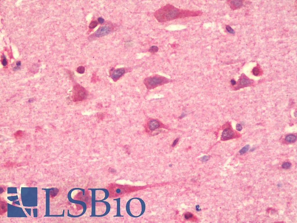 IHC-plus™ Polyclonal Rabbit anti-Human CHUK / IKKA / IKK Alpha Antibody (IHC, IF, WB)