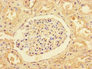 SLC35F6 Antibody