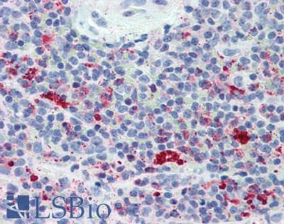 Polyclonal Rabbit anti-Mouse LAG3 Antibody (aa274-504, IHC, WB)
