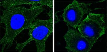 KDR / VEGFR2 / FLK1 Antibody (Amino Acid: 20-764, clone 4B4)
