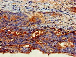 CD66c / CEACAM6 Antibody