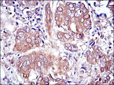 Monoclonal Mouse anti-Human MAPK3 / ERK1 Antibody (clone 100000, IHC, IF, WB)