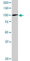 ZAK / MLTK Antibody (clone 3G5)