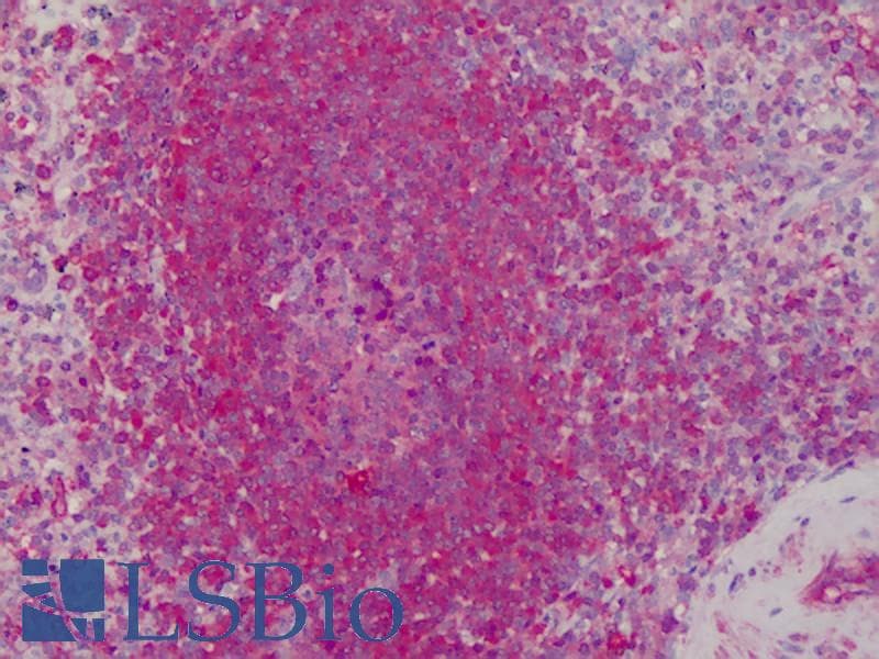 IHC-plus™ PRDX1 / Peroxiredoxin 1 Antibody
