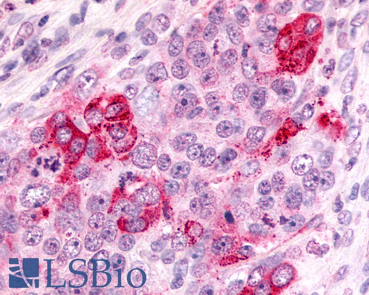 IHC-plus™ CXCR6 Antibody (C-Terminus)