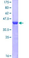 Human AHCYL1 / DCAL Protein (Recombinant GST, N-terminus)
