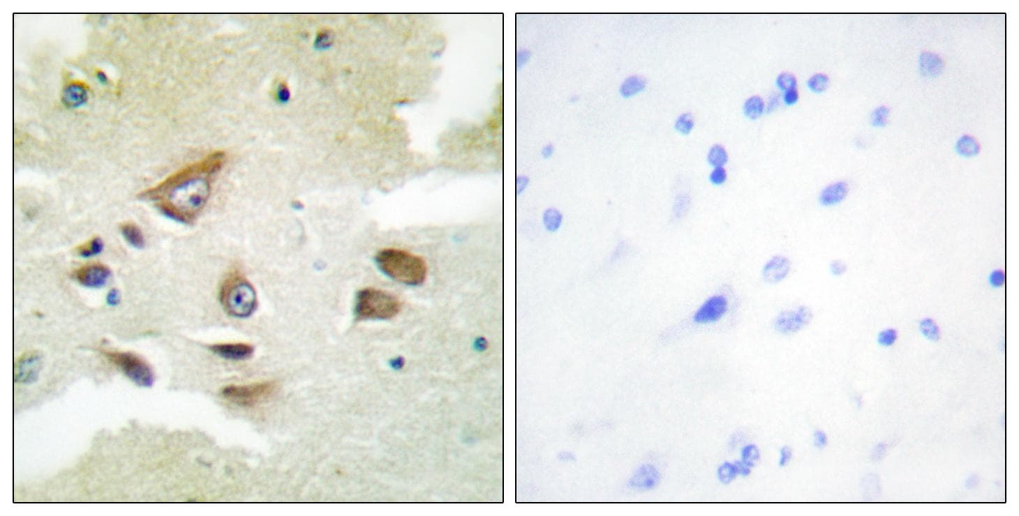Polyclonal Rabbit anti-Human CLU / Clusterin Antibody (IHC, IF, WB)