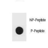 Polyclonal Rabbit anti-Human Hamartin / TSC1 Antibody (phospho-Tyr312)