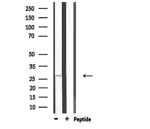Polyclonal Rabbit anti-Human APAF1 / APAF-1 Antibody (IHC, IF, WB)