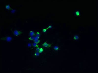 Polyclonal Rabbit anti-Human TMEM174 Antibody (IHC, WB)