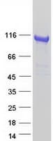 Human AP2B1 Protein (Recombinant Myc-DDK (Flag))