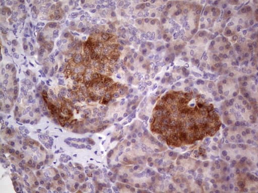 TACC1 Antibody (clone OTI1H2, Carrier-free)